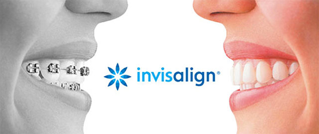 Promoción invisalign