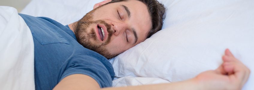 hombre duerme roncando sin tratamiento para ronquidos loscos