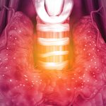 Salud dental en pacientes con hipotiroidismo