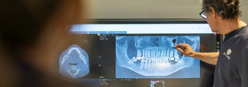 Una imagen de un dentista analizando en una pantalla los dientes de un paciente, de cara a una cirugía. El paciente deberá seguir unos cuidados después de su cirugía oral para evitar infecciones.