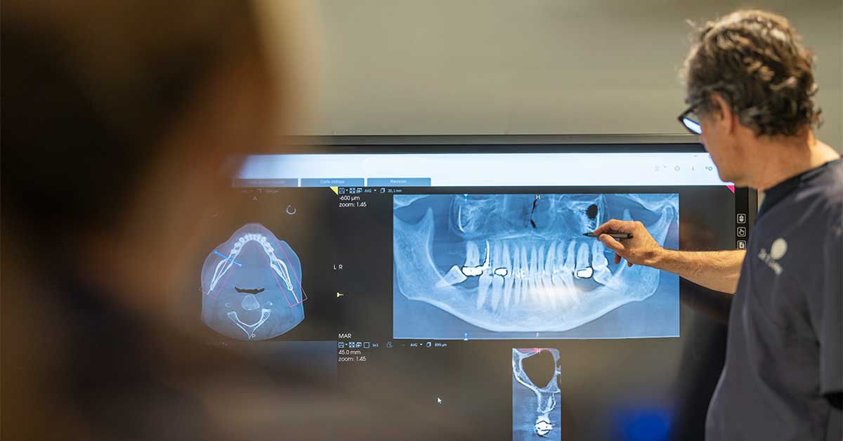 Una imagen de un dentista analizando en una pantalla los dientes de un paciente, de cara a una cirugía. El paciente deberá seguir unos cuidados después de su cirugía oral para evitar infecciones.