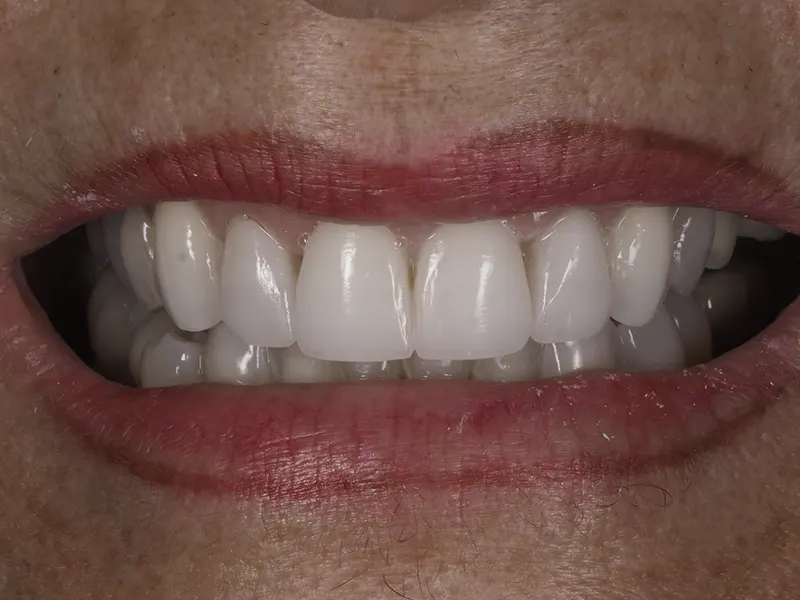 After image