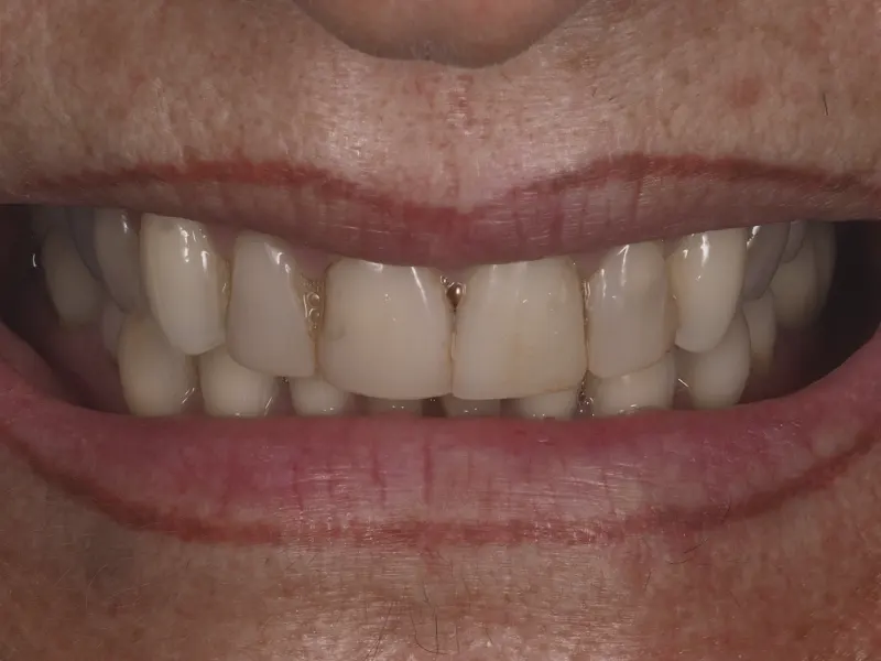 Before image