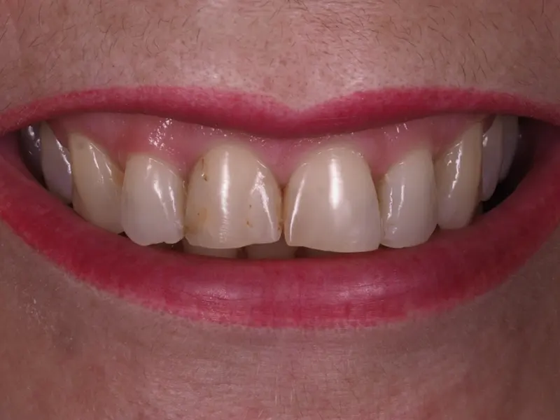Before image