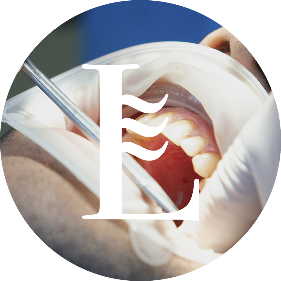 Grafismo de autotransplante dental