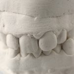 Cómo se cuidaban los dientes en la antigua Roma