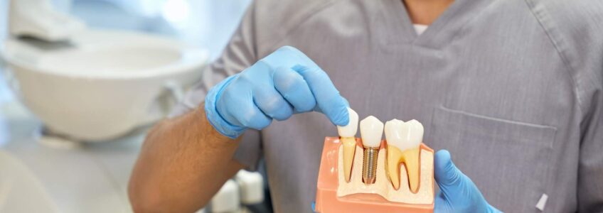 Fallo implante dental tardío